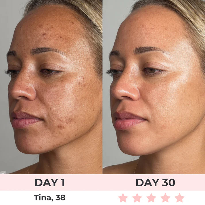 Brandify™7-in-1 LED Facial Sculptor